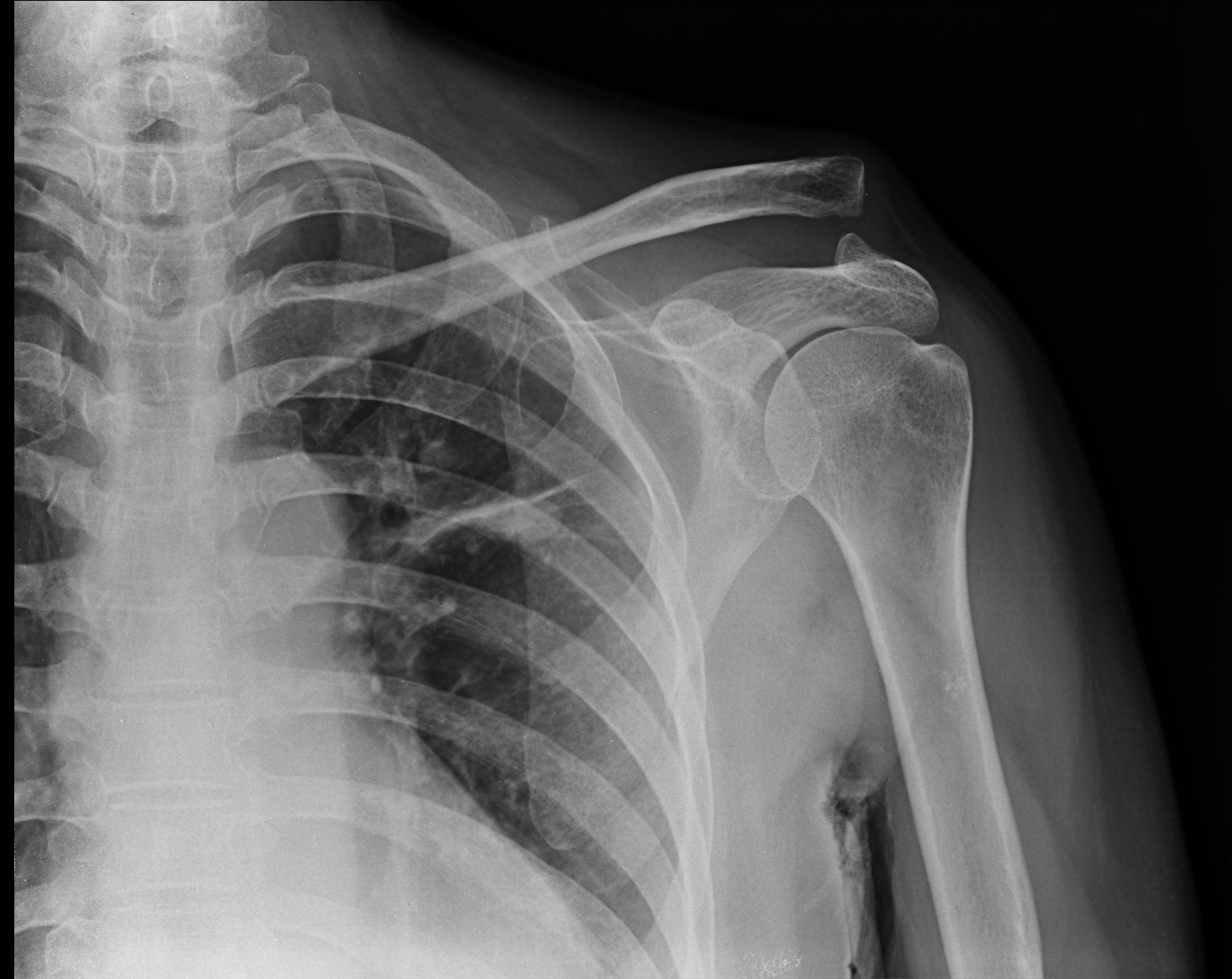 General 3020x2400 medicine x-rays bones skeleton ribs spine monochrome